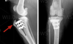 Tibial tuberosity advancement (TTA) diagram