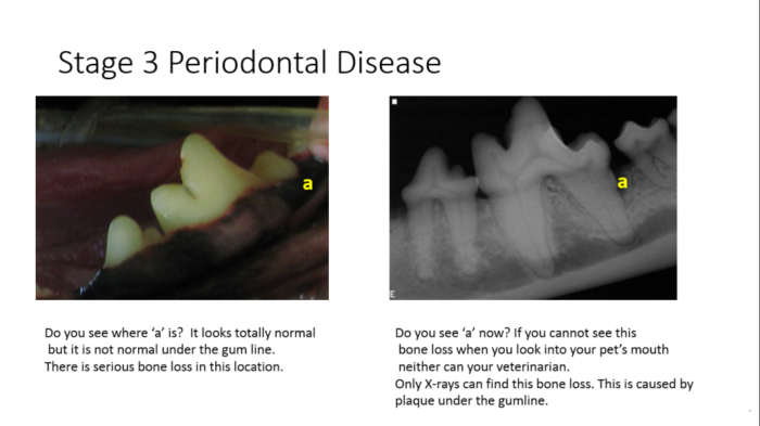 Stage 3 periodontal disease can still look normal but with serious bone loss