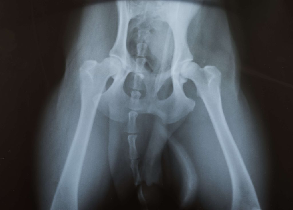 X-ray