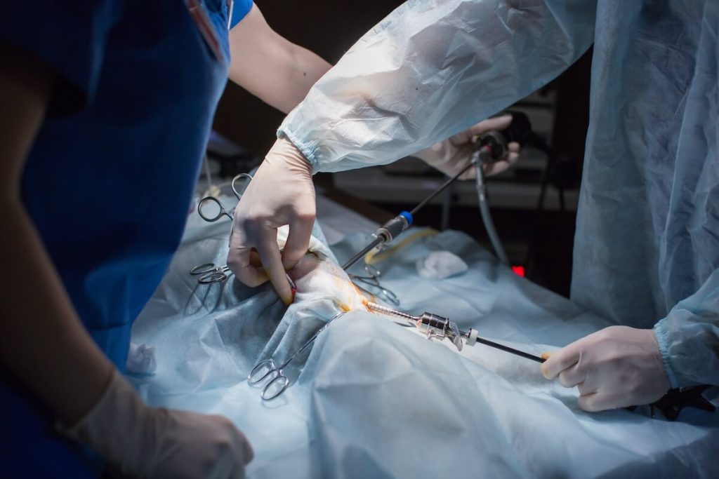 Endoscopy